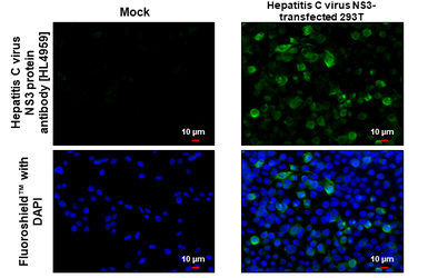 Anti-Hepatitis C virus NS3 protein antibody [HL4959] used in Immunocytochemistry/ Immunofluorescence (ICC/IF). GTX645045